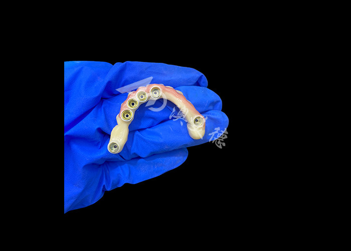Titanyum Abutment ve Zirconia Taç İmplantı Desteklenen Diş Dişleri Rahat giyim için uygun hassaslık
