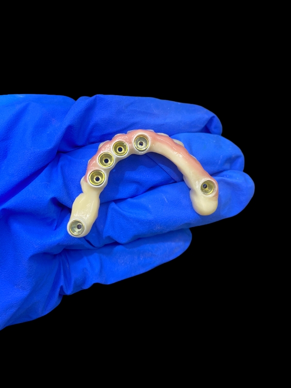 Titanyum Abutment ve Zirconia Taç İmplantı Desteklenen Diş Dişleri Rahat giyim için uygun hassaslık
