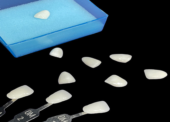 İyi bir fiyat. Porselen Emax Finer Transparency Bonding Precise Estetik Restorasyonlar İçin çevrimiçi