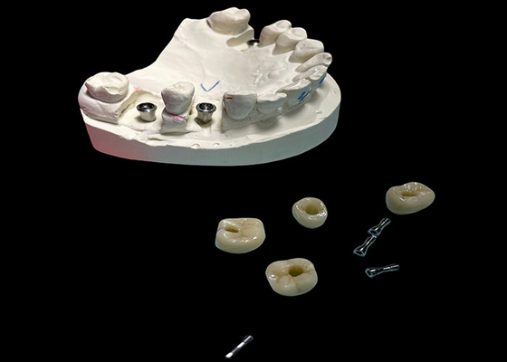 İyi bir fiyat. Parlak yüzeyli diş implantı vida diş değiştirme için taç tutulur çevrimiçi