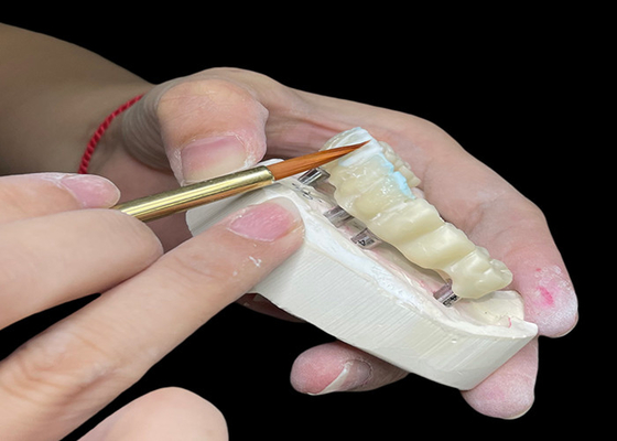 İyi bir fiyat. Kişiselleştirilebilir cilalı diş implantı taç köprüsü kolay hijyen için uzun ömürlü çevrimiçi