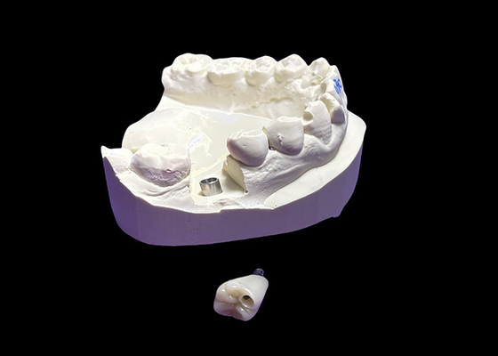 İyi bir fiyat. Diş implantı, seramik taç ve titanyum ile çevrimiçi