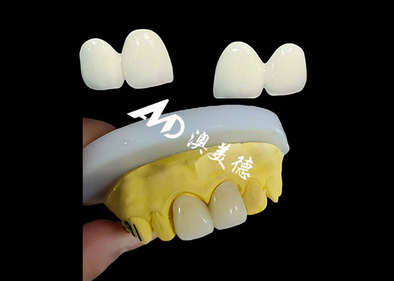 İyi bir fiyat. Çin diş laboratuvarından özel Zirconia Diş Tacı Precise Fit Diş Kapağı çevrimiçi