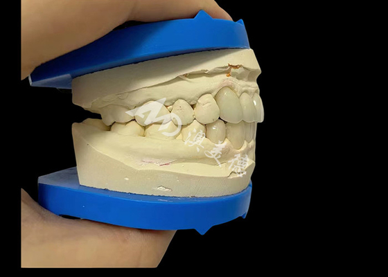 İyi bir fiyat. Doğal görünümlü gülümsemeler için yenilmez Dental Zirconia Dentla Tacı çevrimiçi