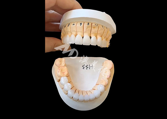 İyi bir fiyat. Tek / Çokbirimli Sabit Restorasyonlar İçin Gelişmiş Şeffaflık Zirkonya Diş Tacı çevrimiçi