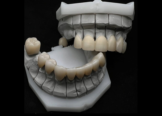 İyi bir fiyat. Tek veya Çoklu Dişler İçin Dental Zirkonya Tacı çevrimiçi
