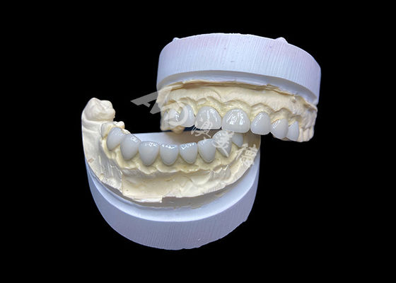 İyi bir fiyat. Özelleştirme Ultra İnce Cam Seramik Veneerler Yüksek Şeffaflık çevrimiçi