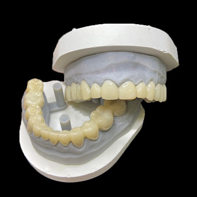 İyi bir fiyat. PMMA Temporary Restorations CAD/CAM PMMA Crowns and Bridges for Provisional Dental Cases çevrimiçi