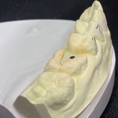 İyi bir fiyat. Restorasyonunuzu Lock Pink Post Core Teknolojisi ile Güçlendirin çevrimiçi