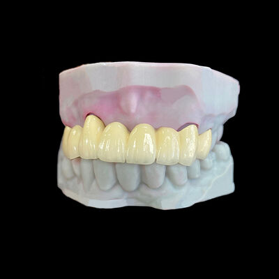 İyi bir fiyat. Co-Cr Çerçeve ile Metal'e Erimiş Porselen (PFM) Tacı çevrimiçi