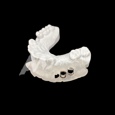 İyi bir fiyat. CAD/CAM freze teknolojisi kullanılarak Renk değişikliğine karşı yüksek dirençli Precise Fit 3D Basılı Cerrahi İmplant Rehberi çevrimiçi